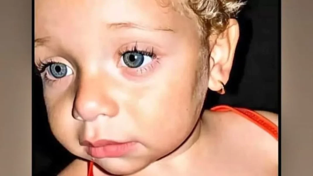 Muere niña resultó herida en explosión en fritura en SFM Muere niña resultó herida en explosión en fritura en SFM